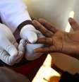 <p>Médico retira amostra de sangue de um homem para exame de HIV/AIDS</p>  Foto: Edward Echwalu / Reuters