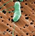 <p>Bactéria vibrio vulnificus pode comer a carne humana, a partir do momento de infecta uma pessoa</p>  Foto: Wikimedia
