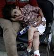 Criança ferida por ataque na cidade síria de Douma  Foto: ABD DOUMANY / AFP