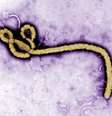 <p>Morfologia ultraestrutural do vírus ebola em foto colorida</p>  Foto: Frederick Murphy / Reuters