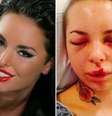 Christy Mack ficou com o rosto deformado após agressão de lutador de MMA  Foto: Twitter / Reprodução