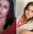 <p>Em foto divulgada pela ativista, ela mostra a mudança que passou desde a época do vício até hoje, cinco anos sem a droga</p>  Foto: Mirror / Reprodução