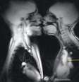 <p>O beijo visto pela máquina de ressonância magnética</p>  Foto: The Mirror / Reprodução