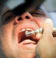 <p>Mark van Nierop &eacute; suspeito de abuso e fraude por sua atividade de dentista</p>  Foto: Thinkstock