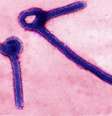 <p>Part&iacute;culas do v&iacute;rus Ebola em imagem de microsc&oacute;pio divulgada por laborat&oacute;rio das For&ccedil;as Armadas dos EUA</p>  Foto: USAMRIID / Reuters