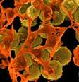 Bactérias resistentes podem ser um grande (e caro) problema para a humanidade nas próximas décadas  Foto: IFL Science / Reprodução