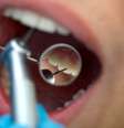 Hoje, os profissionais de odontologia fazem restaurações sem nenhuma dificuldade toda vez que há perda de forma, função ou estética do dente  Foto: Ocskay Mark / Shutterstock