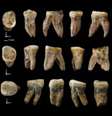 Dentes possuem características híbridas e geram possibilidade de nova espécie   Foto: IFL Science/Centro Nacional de Investigación sobre la Evolución Humana / Reprodução