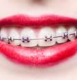 <p>Esse recurso além de disfarçar o uso, pois ninguém imagina que uma pessoa com aparelho use dentadura, ainda tende a rejuvenescer o paciente </p>  Foto: fotorince / Shutterstock