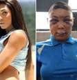 Travesti Verônica Bolina acusa policiais civis e militares de agressão   Foto: Reprodução
