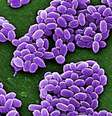 Esporos da variedade Sterne da bactéria antraz (Bacillus anthracis) são retratados nesta imagem de divulgação de microscópio eletrônico de varredura (MEV) obtida pela Reuters  Foto: CDC / Reuters