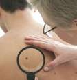 Pesquisa foi feita com 945 pacientes com melanoma avançado  Foto: BBC News Brasil