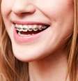 Com tratamento inovadores é possível tratar os dentes ainda em desenvolvimento e evitar aparelhos na adolescência e vida adulta  Foto: auleena / Shutterstock