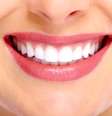 Durabilidade, resistência, brilho e semelhança com dente naturais fazem da porcelana o queridinho quando o assunto é restauração  Foto: kurhan / Shutterstock