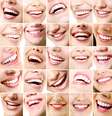 Especialista defende o contraste como a melhor forma de harmonizar o sorriso com o resto do rosto  Foto: vita khorzhevska / Shutterstock