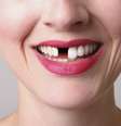 Cuidados importantes com higiene bucal evitam perda dos dentes  Foto: iStock / Getty Images