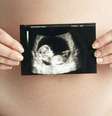 Novos estudos tentarão descobrir quais as chances de mulher que contraiu zika na gravidez ter bebê com má-formação   Foto: Thinkstock