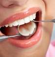 Os dentes do siso costumam surgir no início da fase adulta.  Foto: iStock/Getty Images / Vivo Mais Saudável