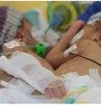 Lydia e Maya antes da sepração: uma tinha pressão alta, por ter muito sangue em circulação  Foto:  BBC / BBC News Brasil