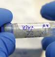 Avanço da microcefalia e do zika vírus nas Américas foi declarado emergência internacional pela OMS nesta semana  Foto: Divulgação/BBC Brasil / BBCBrasil.com