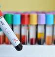  Foto: iStock