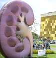 Dados de  2012 do Ministério da Saúde indicam que 100 mil pacientes fazem diálise, processo de filtragem do sangue – uma das funções do rim  Foto: Fotos Públicas