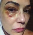 Luiza Brunet foi agredida por Lírio Parisotto no dia 21 de maio de 2016  Foto: Divulgação, TV Globo / PurePeople