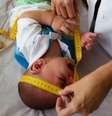Segundo o último boletim epidemiológico do Ministério da Saúde, o País tem 3.086 casos em investigação para microcefalia associada ao Zika.  Foto: Agência Brasil