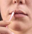 Apesar do número de pessoas que tem o vírus do herpes ser bem grande, apenas 10% delas vão ter reativações que são as infecções por herpes recorrentes  Foto: Artem Efimov / Shutterstock