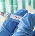 A partir do ano que vem os meninos vão ser incluídos na campanha de vacinação contra o HPV, segundo Ministério da Saúde  Foto: iStock