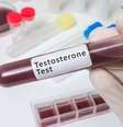 O uso do suplemento de testosterona só é recomendado se houver um diagnóstico médico  Foto: Thinkstock