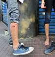 Manifestante mostra ferimento de bala de borracha durante protesto em São Paulo em outubro de 2016  Foto: Agência Brasil