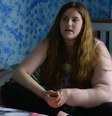 Leah já passou mais de 30 cirurgias para reduzir o tamanho do seu braço  Foto: BBC / BBC News Brasil