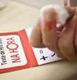 Desde a sua descoberta, em 1981, o vírus HIV já provocou 36 milhões de mortes.  Foto: Agência Brasil