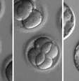 Fotos de embriões geneticamente modificados: cientistas conseguiram editar genes que causavam a cardiomiopatia hipertrófica a ser transmitida de pais para filhos   Foto: BBCBrasil.com