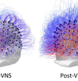 Imagens da atividade cerebral do paciente  Foto: BBC News Brasil