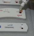 Testes rápidos de HIV, hepatite B e C e sífilis disponiveis em unidades da rede publica de Saúde  Foto: Agência Brasil