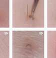 Vídeos com remoção de pelos  Foto: BBC News Brasil