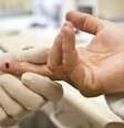 Diagóstico precoce do vírus HIV e o início do tratamento é considerado o método mais eficaz de prevenir mortes por aids e causas associadas  Foto: Agência Brasil