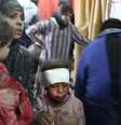 Feridos em bombardeio buscam tratamento em hospital improvisado em Kafr Batna, em Ghouta Oriental  Foto: AFP / BBC News Brasil