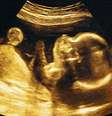 Foto: Getty Images