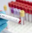 Segundo estudo publicado na revista acadêmica The Lancet, a vacina preventiva para HIV deu 67% de proteção contra o vírus  Foto: Getty Images / BBC News Brasil