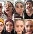 Jen Taylor, de 30 anos, diz que tirar uma foto todos os dias do próprio rosto ajudou a enfrentar as mudanças depois da cirurgia de reconstrução facial  Foto: Jen Taylor / BBC News Brasil