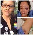 A vítima ficou com hematomas pelo rosto e teve um dos braços quebrados.  Foto: Facebook/Reprodução / Estadão Conteúdo