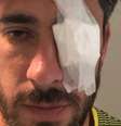 Pablo Perez sofreu ferimentos no olho após ataque; imagem foi divulgada pelo médico do Boca Juniors  Foto: @jpbatista20 / Instagram / Divulgação