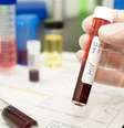 Ainda não há cura viável para o HIV; casos como o de Brown são muito raros  Foto: iStock