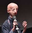 Itália opera coração de paciente com progeria pela 1ª vez  Foto: ANSA / Ansa - Brasil