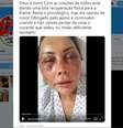 Empresária aparece com o rosto inchado e ferido em vídeo postado no Twitter  Foto: Twitter/Reprodução / Estadão