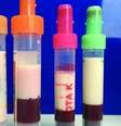 O sangue do paciente tinha uma "cor leitosa" (Foto: American College of Physicians)  Foto: ANNALS OF INTERNAL MEDICINE / BBC News Brasil