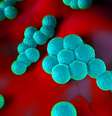 Segundo infectologista, a Staphylococcus aureus é relativamente comum, mas risco de morte é muito baixo - no entanto, pode ocorrer em pessoas com organismos mais frágeis  Foto: Getty Images / BBC News Brasil